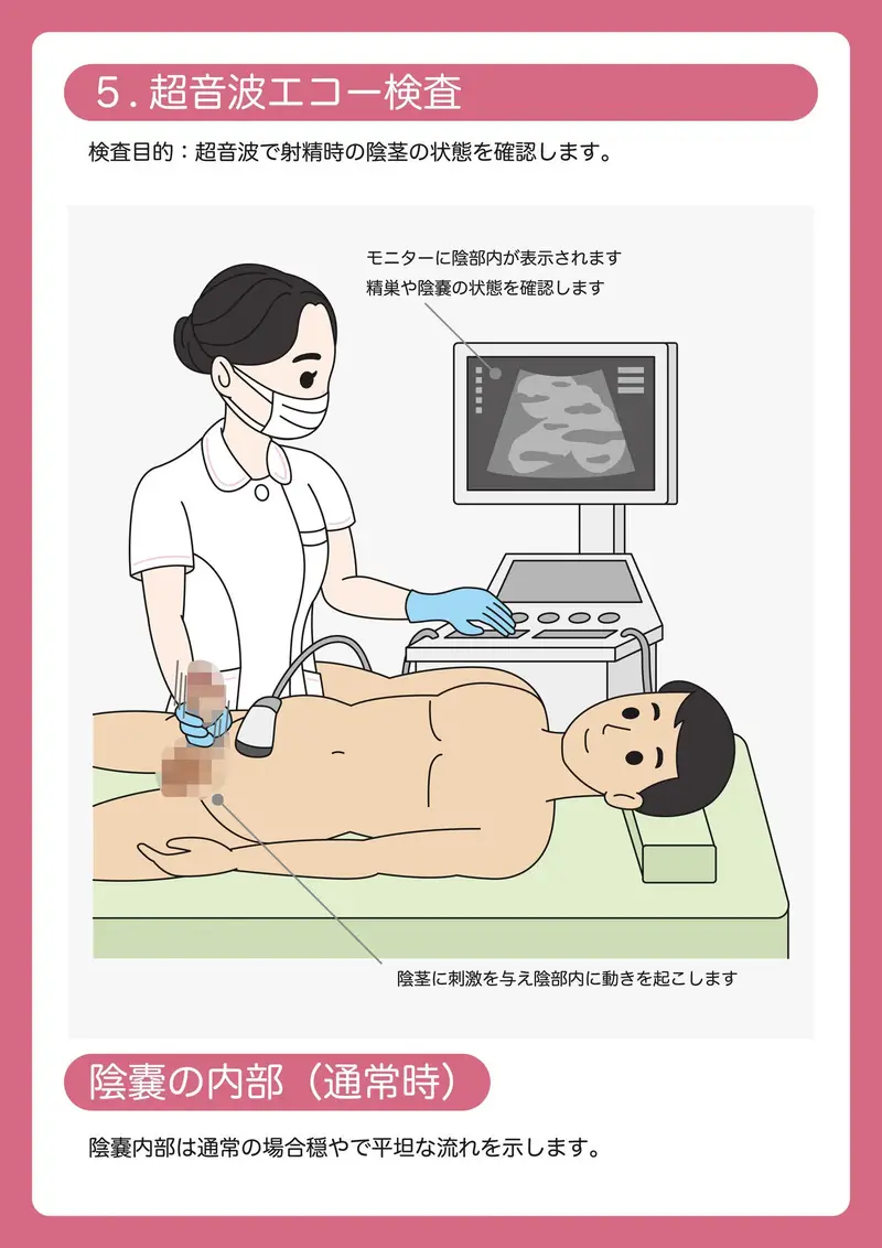 陰茎健診のご案内 サンプル画像 6枚目